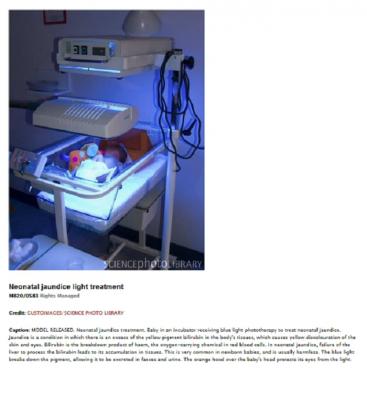 Lámpara UV-B PL-S 9W 52 2P - Terapia médica para la ictericia 8222-18221
